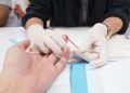 As ações acontecem na próxima terça-feira