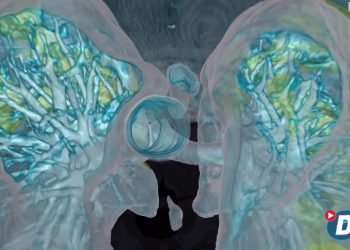 Vídeo mostra dano causado pela Covid-19 aos pulmões